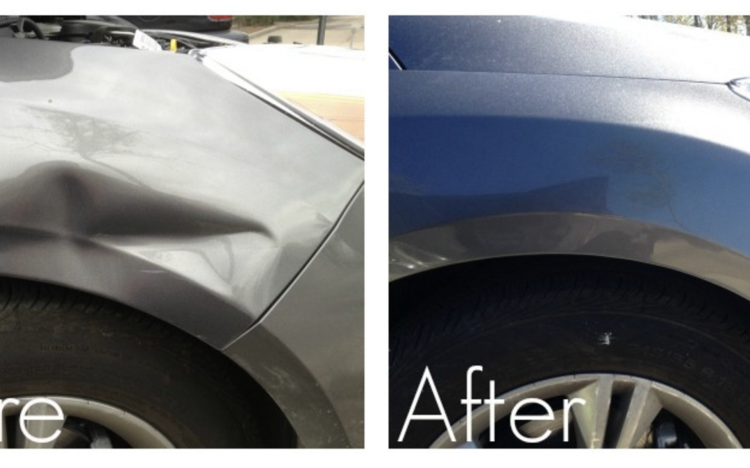 The Convenience Of Dent Removal